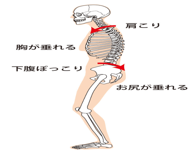 猫背になると、胸が垂れ、下腹部がポッコリ、お尻も垂れて、肩こりも起こりやすくなります。