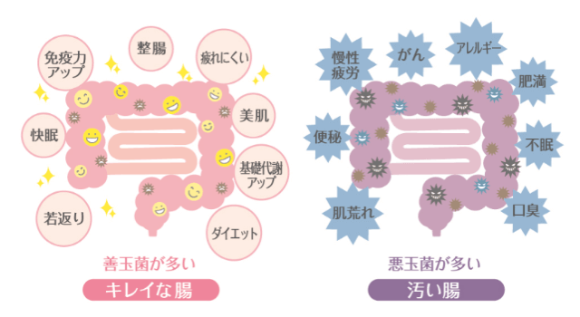 汚い腸ときれいな腸の違い。